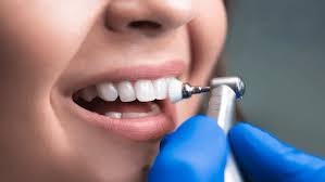 Understanding The Different Types Of Dental Cleanings